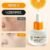 Gongpei Whitening Spot Removing Essence, 35ml, 1ea